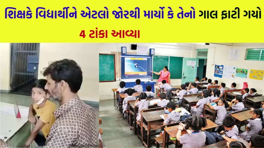 Kota Teacher Slaps Student