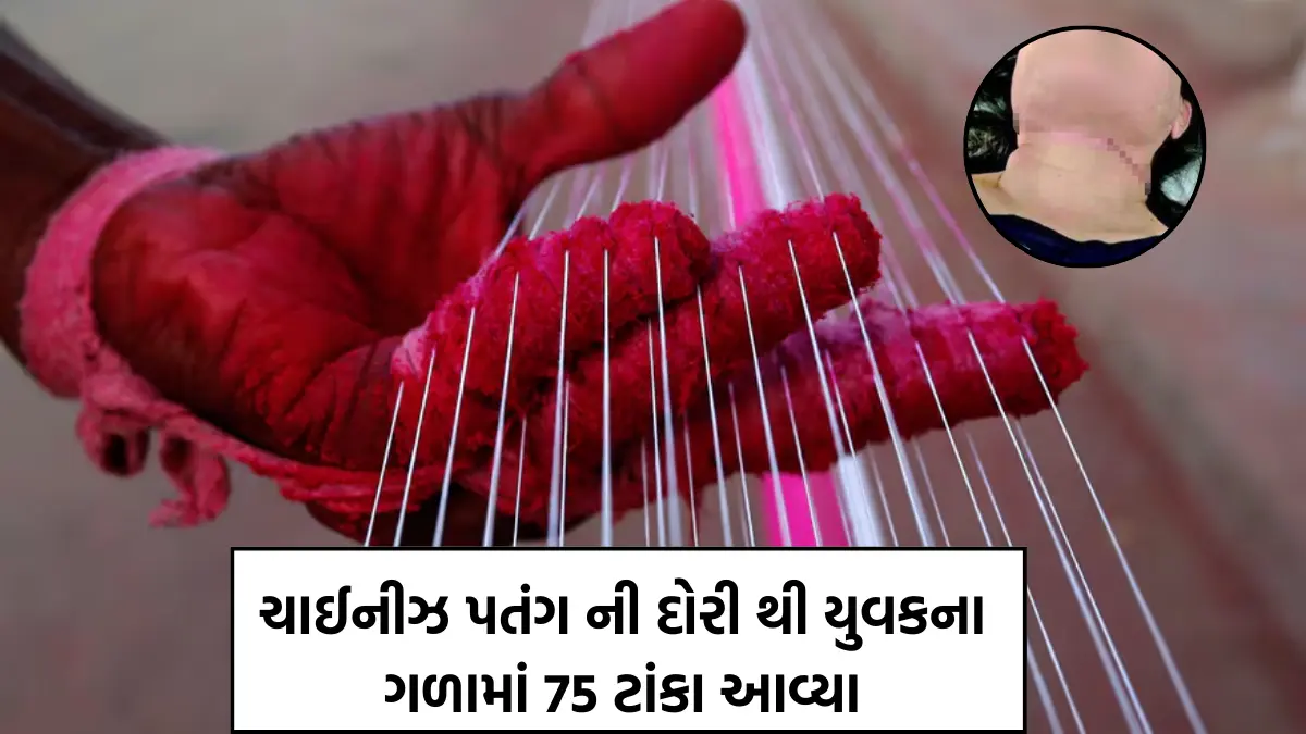 Surat youth gets 75 stitches after Chinese kite string